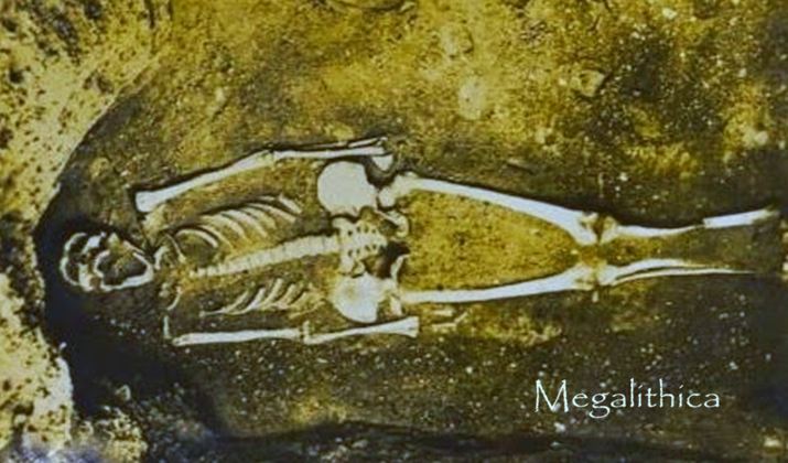 San Leandro, California Coroner Declares Ancient Skeleton was 8 Feet Tall.