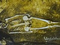 San Leandro, California Coroner Declares Ancient Skeleton was 8 Feet Tall.